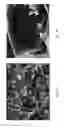 Fig. 09 - Removal of barite weighted mud