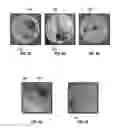 Fig. 04 - On the fly mixing of acids and diversion fluids with water-soluble retarding agents