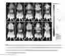 Fig. 07 - Homogeneous persistent luminescence nanocrystals and methods of preparation and application thereof