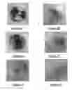 Fig. 02 - Method of forming an antifoam granule containing a silicone polyether