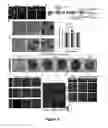 Fig. 04 - METHOD FOR GENERATING SOMATIC STEM CELLS