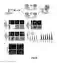Fig. 14 - METHOD FOR GENERATING SOMATIC STEM CELLS