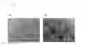 Fig. 33 - Pluripotent stem cell production system