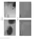 Fig. 11 - METHODS AND COMPOSITIONS FOR EXPANSION AND DIFFERENTIATION OF SKELETAL MUSCLE STEM CELLS OR PROGENITOR CELLS
