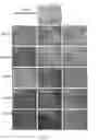 Fig. 16 - METHOD FOR INDUCING DIFFERENTIATION OF STEM CELLS