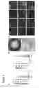 Fig. 07 - Three-dimensional differentiation of epiblast spheroids to kidney organoids models stage-specific epithelial physiology, morphogenesis, and disease