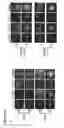 Fig. 35 - Three-dimensional differentiation of epiblast spheroids to kidney organoids models stage-specific epithelial physiology, morphogenesis, and disease