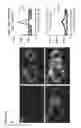 Fig. 49 - Three-dimensional differentiation of epiblast spheroids to kidney organoids models stage-specific epithelial physiology, morphogenesis, and disease