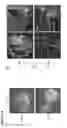 Fig. 66 - Three-dimensional differentiation of epiblast spheroids to kidney organoids models stage-specific epithelial physiology, morphogenesis, and disease