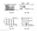 Fig. 11 - Scaffold proteins derived from plant cystatins