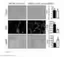 Fig. 21 - Methods and compositions to treat liver diseases and conditions