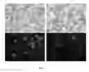 Fig. 06 - Transfection vector for pathogenic amoebae and uses thereof