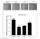 Fig. 01 - Antibody to human and mouse SEMA3A and use thereof