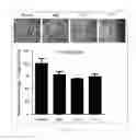 Fig. 11 - Antibody to human and mouse SEMA3A and use thereof