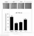 Fig. 22 - Antibody to human and mouse SEMA3A and use thereof