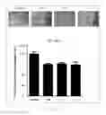 Fig. 23 - Antibody to human and mouse SEMA3A and use thereof