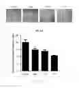 Fig. 24 - Antibody to human and mouse SEMA3A and use thereof