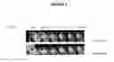 Fig. 04 - Bacteria identification and antimicrobial susceptibility test