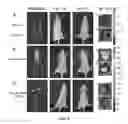 Fig. 10 - In vivo detection of phospholipase activation