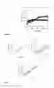Fig. 14 - PAPER DEVICE FOR GENETIC DIAGNOSIS