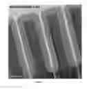 Fig. 03 - Methods for depositing a conformal metal or metalloid silicon nitride film and resultant films