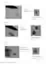 Fig. 06 - Single crystal of porous compound, method for assessing quality of single crystal, method for preparing solution including compound to be analyzed, method for producing crystal structure analysis sample, and method for determining molecular structure of compound to be analyzed