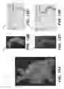 Fig. 15 - Method for generating an electro spun fiber medical implant