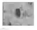 Fig. 02 - METHOD FOR PRODUCING A STRUCTURED MICROFILAMENT NONWOVEN