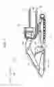 Fig. 02 - Safety device for a construction machine