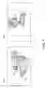 Fig. 04 - Implement orientation by image processing