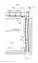 Fig. 01 - Systems and methods for wall support and/or straightening