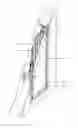 Fig. 02 - Fire-blast resistant door assembly and methods for installing the same