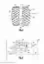 Fig. 04 - Turbine engine gearbox