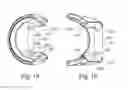 Fig. 09 - CONVERGENT-DIVERGENT NOZZLE FOR A TURBOFAN ENGINE OF A SUPERSONIC AIRCRAFT AND METHOD FOR REDUCING THE BASE DRAG BEHIND SUCH NOZZLE