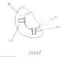 Fig. 13 - WASHERS FOR OVER-TIGHTENING PREVENTION OR MITIGATION