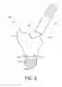 Fig. 03 - Lighting device and luminaire with frangible exit window and resilient member