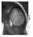 Fig. 07 - Backlit lamp having directional light source