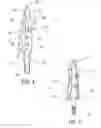 Fig. 02 - Self locking broadhead blade