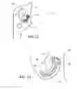 Fig. 07 - Self locking broadhead blade