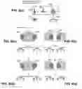 Fig. 05 - Position sensor and method of position sensing