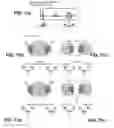 Fig. 06 - Position sensor and method of position sensing