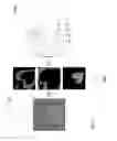 Fig. 06 - Color separation in images