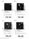 Fig. 07 - Photothermal imaging device and system
