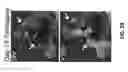 Fig. 07 - Isolation of human lung progenitors derived from pluripotent stem cells