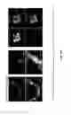 Fig. 09 - Isolation of human lung progenitors derived from pluripotent stem cells