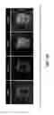 Fig. 42 - Isolation of human lung progenitors derived from pluripotent stem cells