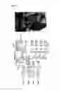 Fig. 06 - Microaspiration-based lung window apparatus for obtaining microscopic image of in vivo lung tissue and method for obtaining image using same