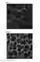 Fig. 07 - Microaspiration-based lung window apparatus for obtaining microscopic image of in vivo lung tissue and method for obtaining image using same
