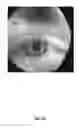 Fig. 03 - Lens position adjustment in a wearable device