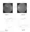 Fig. 04 - Eye tracking